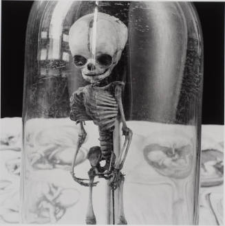 Fetal Skeleton in Bell Jar, Anatomic Treatises, From 'Bones & Bell Jars: Photography of the Mutter Museum Collection'