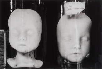 Wax Models (moulages) of Skin Eruptions, From 'Bones & Bell Jars: Photography of the Mutter Museum Collection'