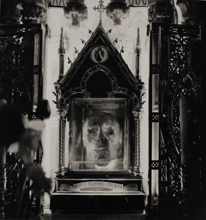 The Head of Blessed Oliver Plunkett, Ireland