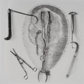 Placenta in situ with Extraction Tools and Scissors, From 'Bones & Bell Jars: Photography of the Mutter Museum Collection'