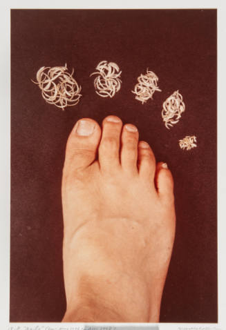 Nails: Foot (from May 1976 to May 1978)