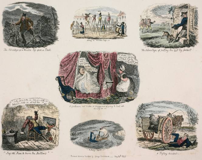 The Advantage of a Wooden Leg upon a Pinch